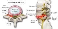 Advanced Spine & Disc image 3